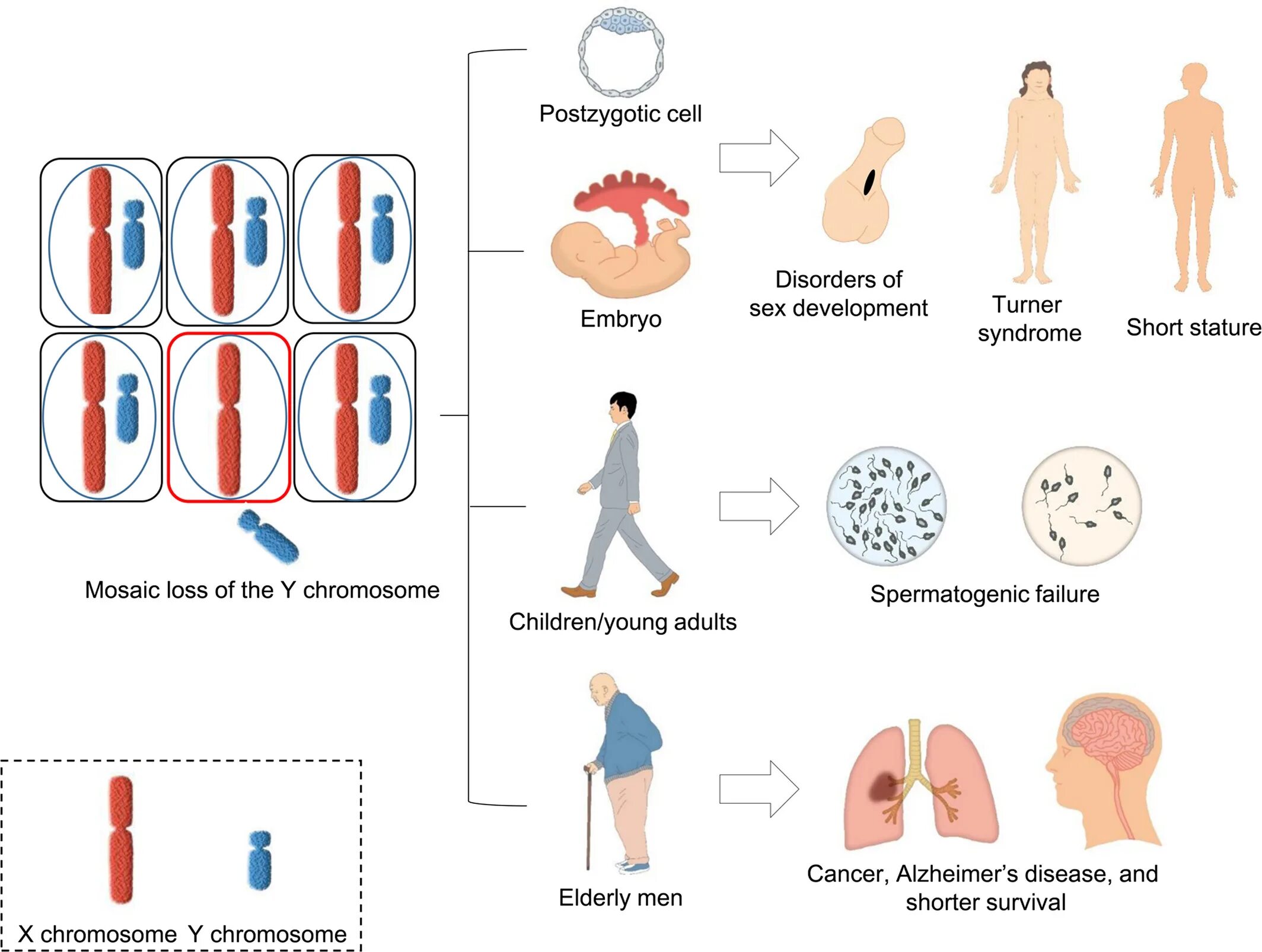 Уменьшение y хромосомы. Хромосомный набор человека. Chromosomal mosaicism.