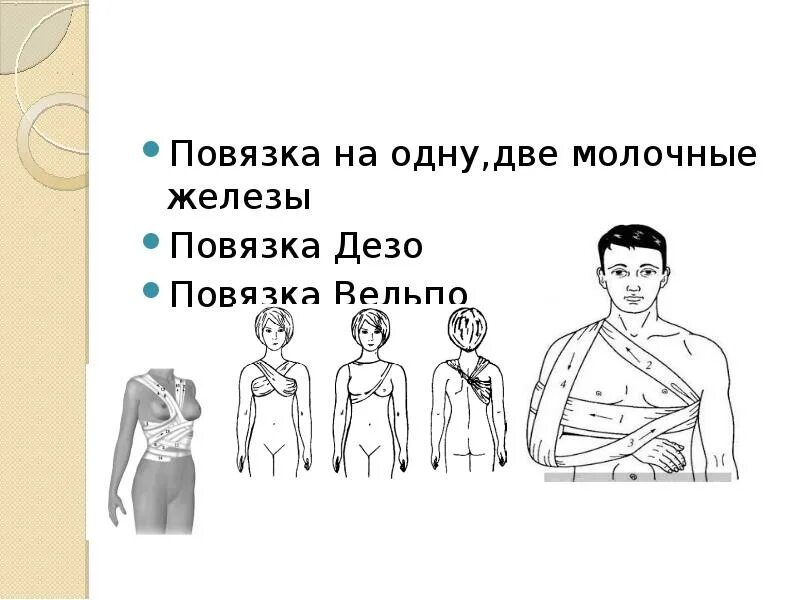 Повязка на молочные железы алгоритм. Косыночной повязки на молочную железу. Повязка на две молочные железы. Десмургия повязка на молочную железу. Повязка Дезо и Вельпо.