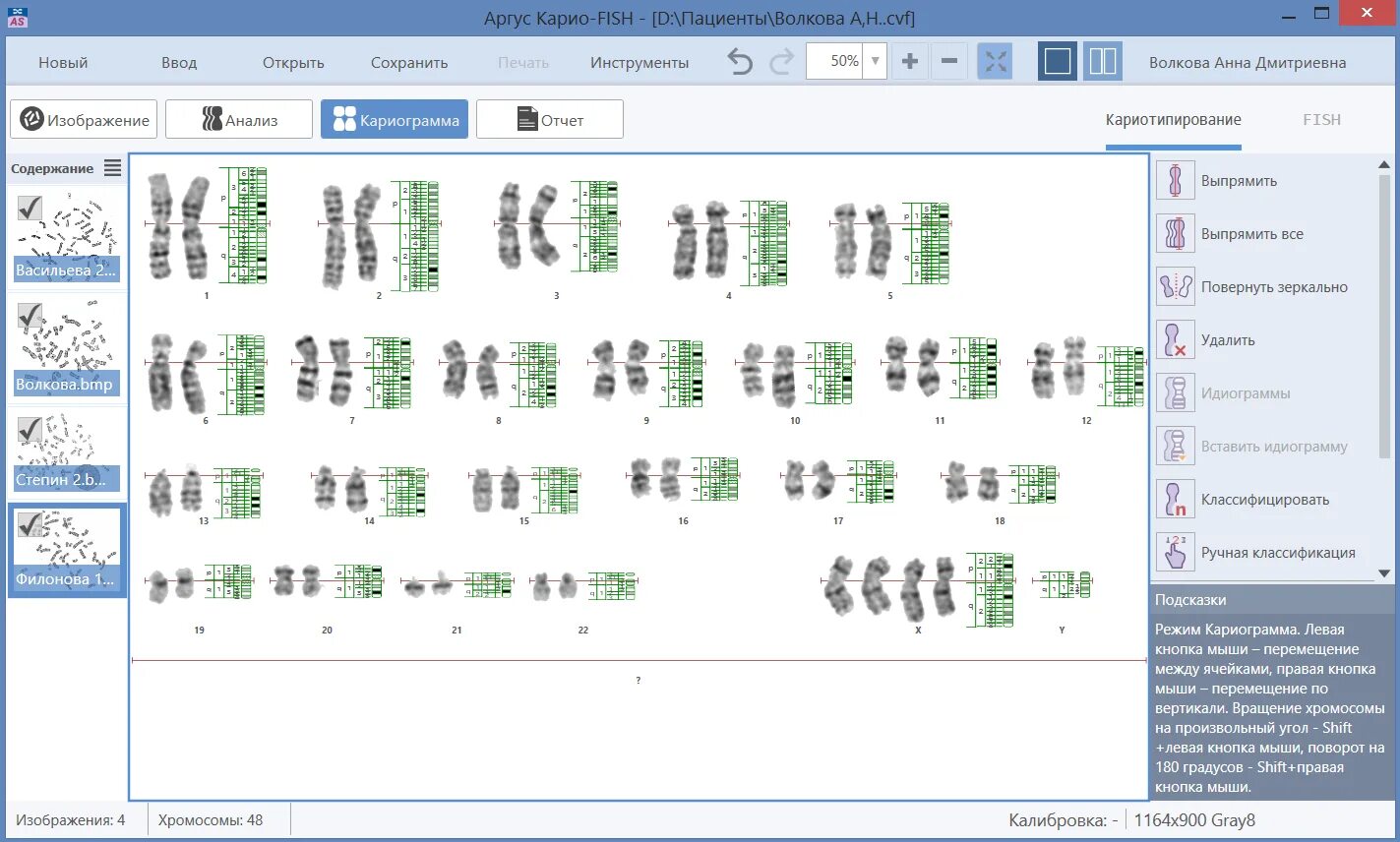 По для автоматического анализа хромосом, кариотипирования, Аргус-Karyo. Хромосомный анализ. Софт для микроскопии. Программа для автоматического анализа кариотипа человека.