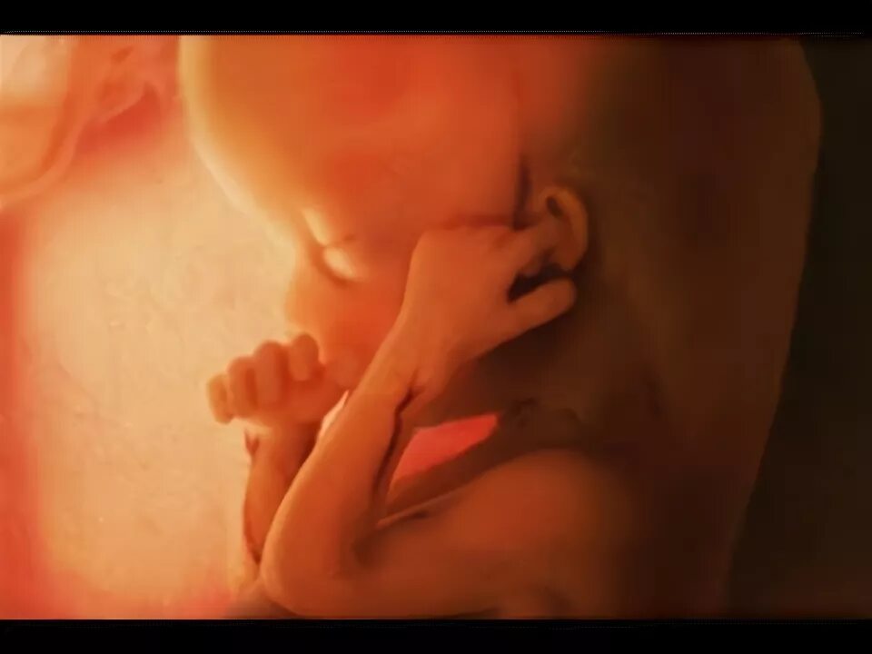Страница 19927 - Зачатие - общайтесь на форуме BabyBlog