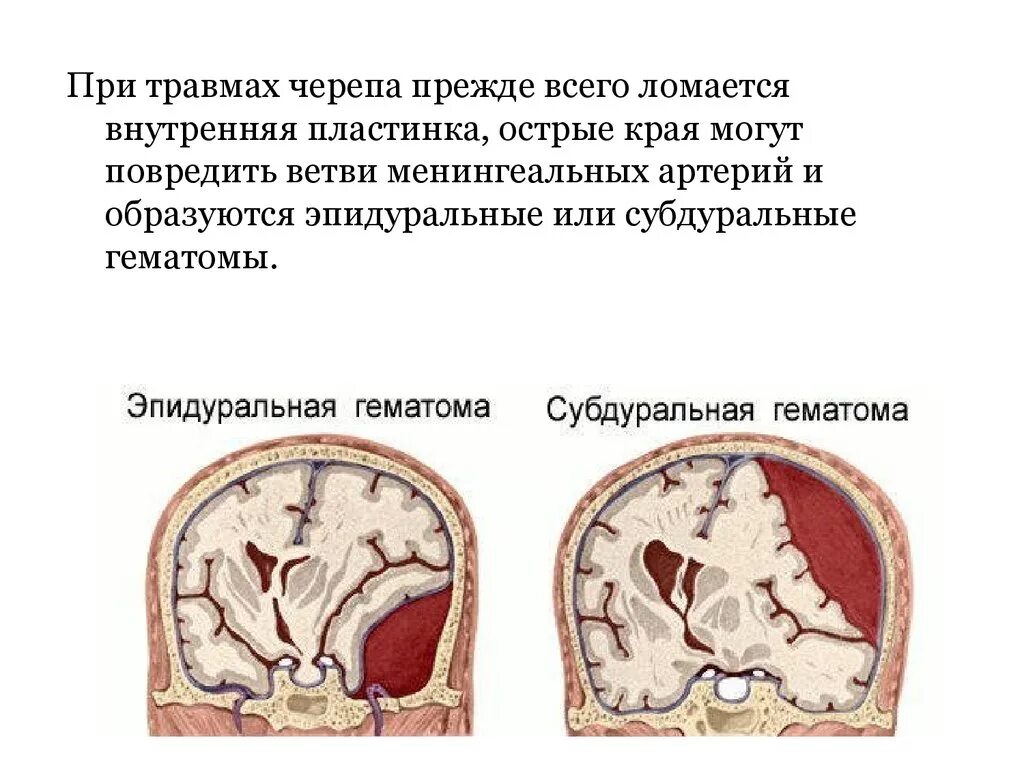 Внутренняя пластинка черепа. Строение кости свода черепа анатомия. Кости свода черепа. Основные признаки строения костей свода черепа. Особенности строения костей свода черепа.