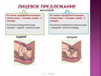 Лицевое предлежание