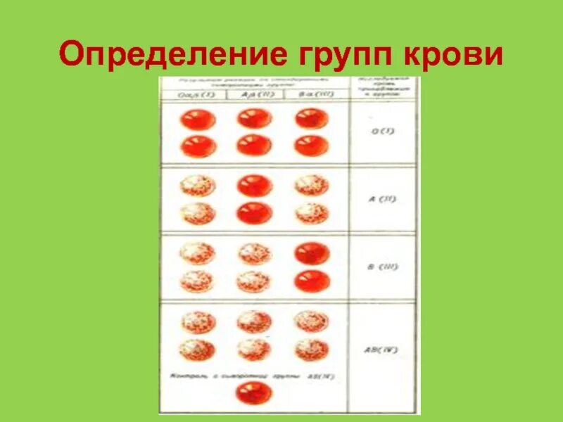 Определение группы крови по цоликлонам. Определить группу крови алгоритм. Группа крови алгоритм. Инвентарь для определения группы крови. Определение группы крови и резус алгоритм