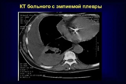 Болит кт