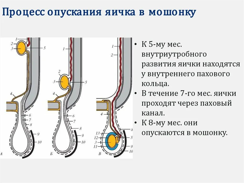 Можно детей одно яичко у мужчины