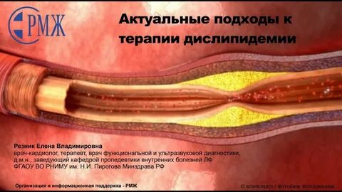 Сосуды у пожилых