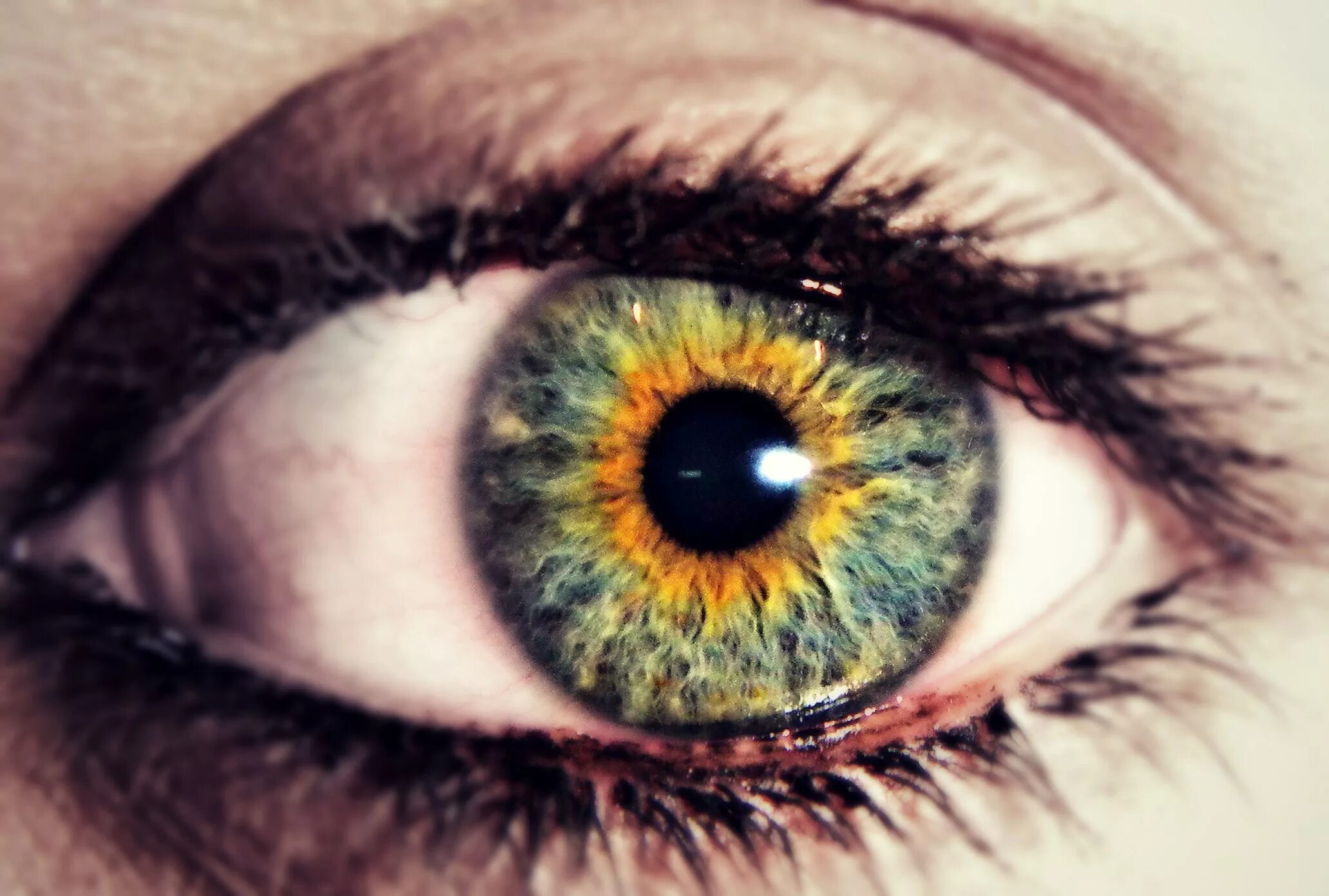 Центральная гетерохромия глаз. Центральная гетерохромия зеленый Карий. Гетерохромия Иридиум. Цвет глаз гетерохромия Центральная. Different eye