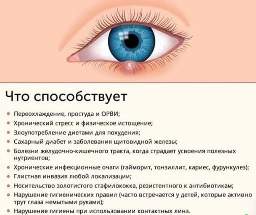 Как избавиться в домашних условиях от ячменя. Ячмень на глазу психосоматика.