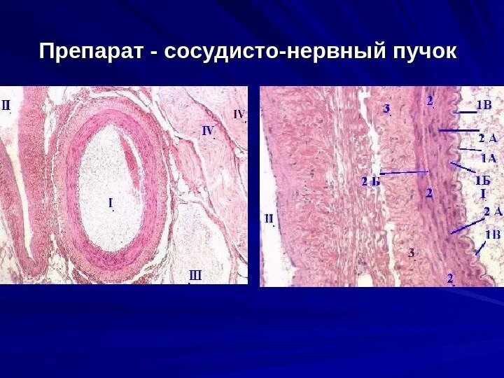 Нервный пучок гистология. Сосудисто нервный пучок гистология. сосудисто нервный пучок препарат. нервно сосудистый пучок гистология препарат. нервный пучок гистология препарат.