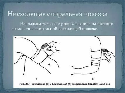 Какая повязка накладывается