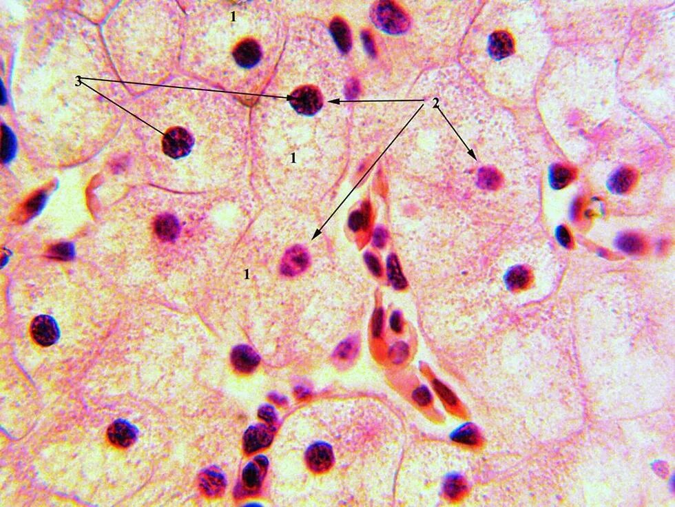 Включения гликогена гистология. Клетки печени гепатоциты. Гепатоциты гистология препарат. Клетки печени аксолотля. Клетки печени в дистиллированной воде