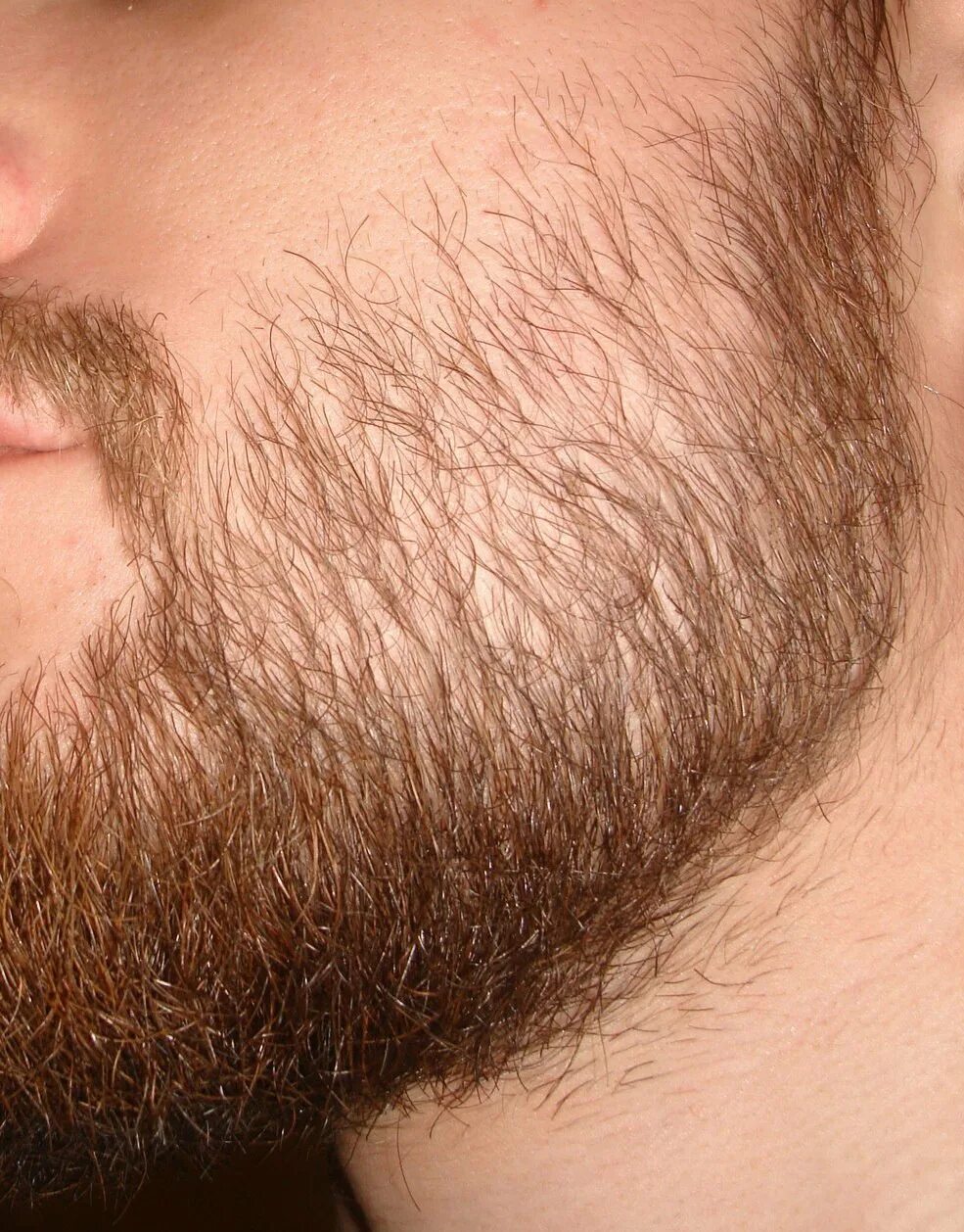 Пушковая борода миноксидил. Щетина на лице. Щетинистые волосы. Редкая борода. Какие волосы на бороде