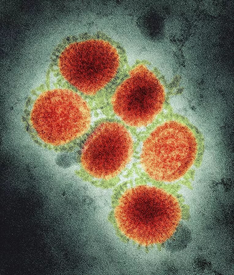 Вирус гриппа h1n1. Вирус гриппа под микроскопом h1n1. Вирус h1n1 испанка. Испанский грипп h1n1 вирус. Орви клетка