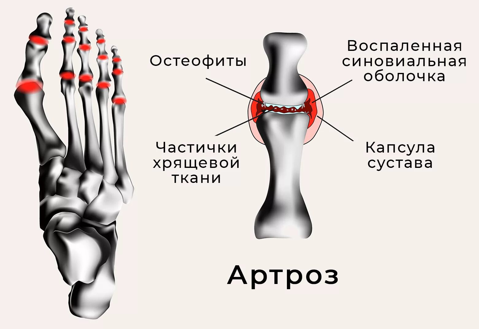 Суставы стопы. Межфаланговые суставы стопы.