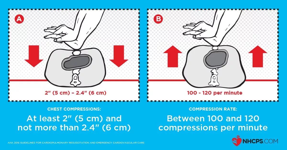 Compressions io. Compressions.. cpr 452.