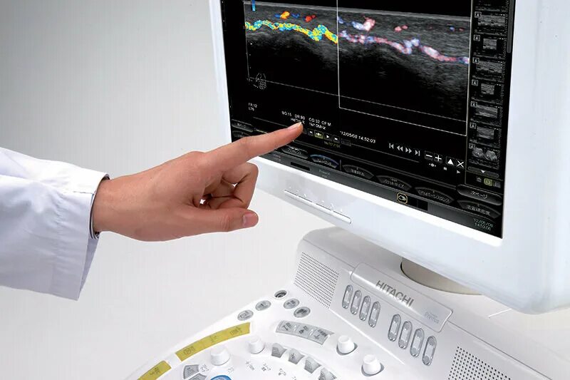 система медицинская. кэнон аплио 400 аппарат узи. современное медоборудование. современное оборудование в медицине. цифровые технологии в медицине.