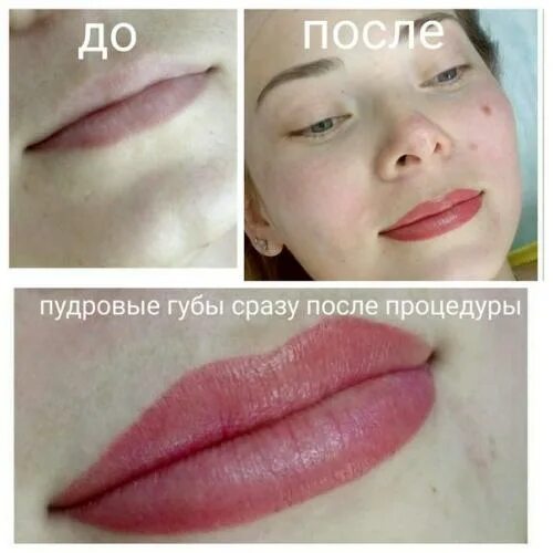 Пудровые губы фото до и после Татуаж губ фото до и после (+ 50 фото) Makeup, Lip fillers, Perfect brows