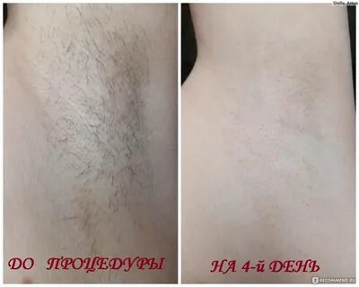 Длина для депиляции воском