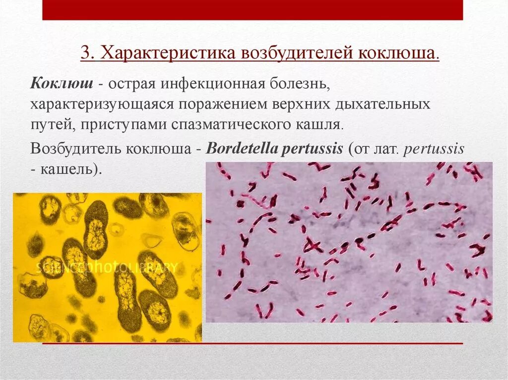 Коклюш бактериальная. Бордетеллы коклюша морфология. Коклюшная палочка микробиология. Коклюш и паракоклюш возбудитель. Возбудитель коклюша микробиология.