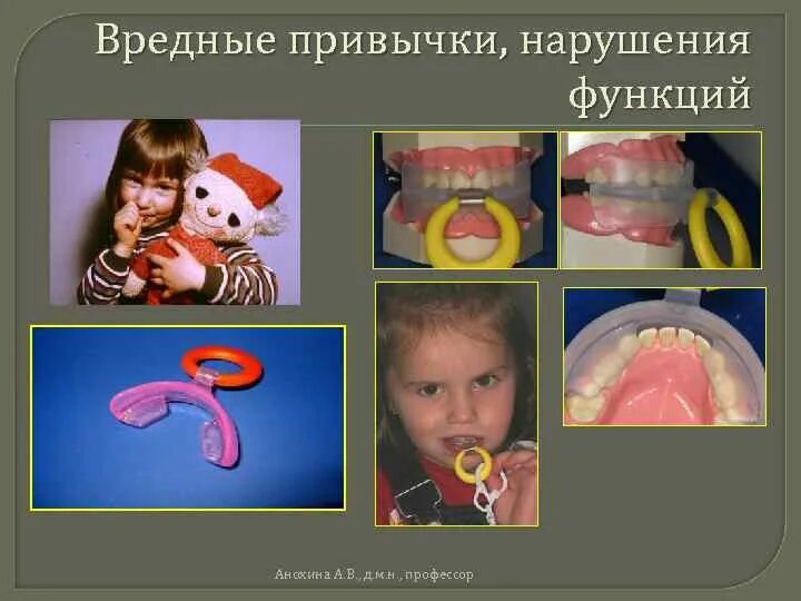 Миофункциональные нарушения в логопедии. Миофункциональные нарушения в логопедии