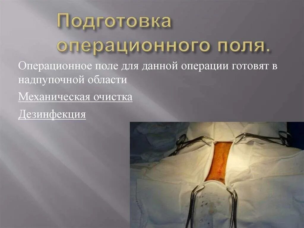 Средство для обработки на операции. Обработка операционного поля йодом. подготовка операционного поля. подготовка операционного поля к операции. этапы подготовки операционного поля.