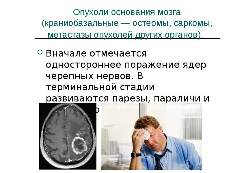 Опухоли нервной системы. Злокачественные новообразования ЦНС. Опухоли центральной нервной системы. Опухоли лекц я. Опухоли мозга у подростков