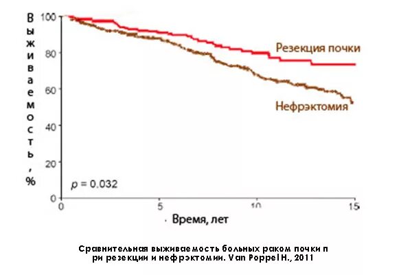 Статистика операций онкология почки. Выживаемость после удаления почки. Нефрэктомия статистика по России. Удаление почки стадии т3bn1м0 прогноз выживаемости. Рак почки выживаемость