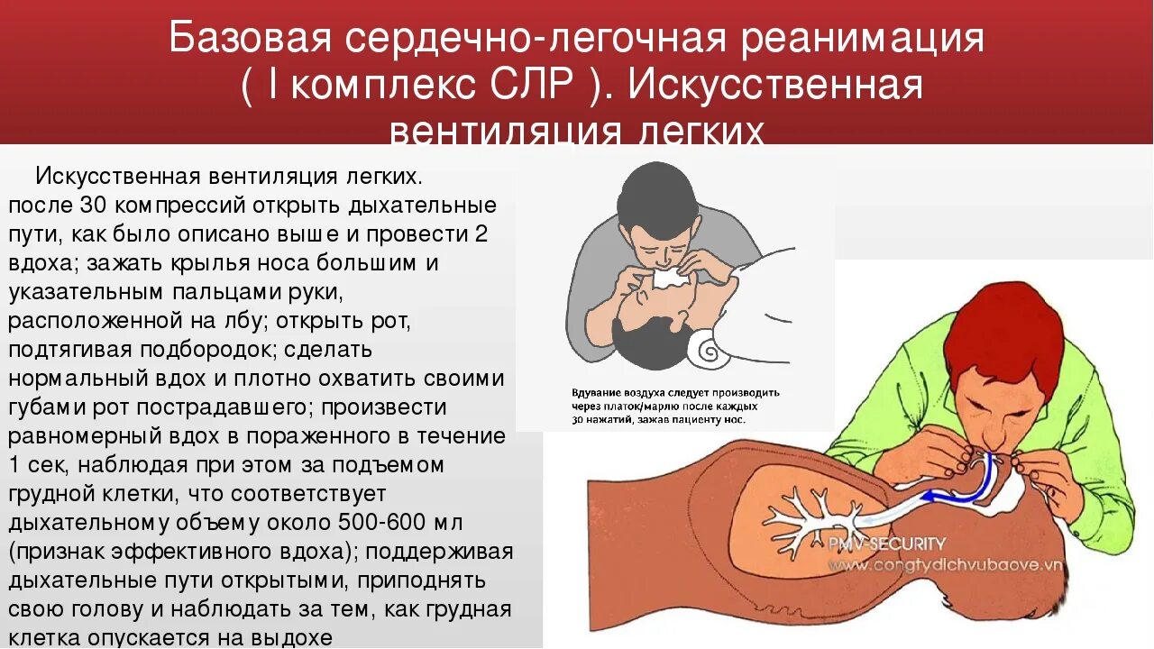 К первому этапу реанимации относится. Искусственная вентиляция при СЛР. Глубина компрессий грудной клетки при СЛР. Вентиляция легких ИВЛ СЛР. Глубина компрессий при сердечно-легочной реанимации.