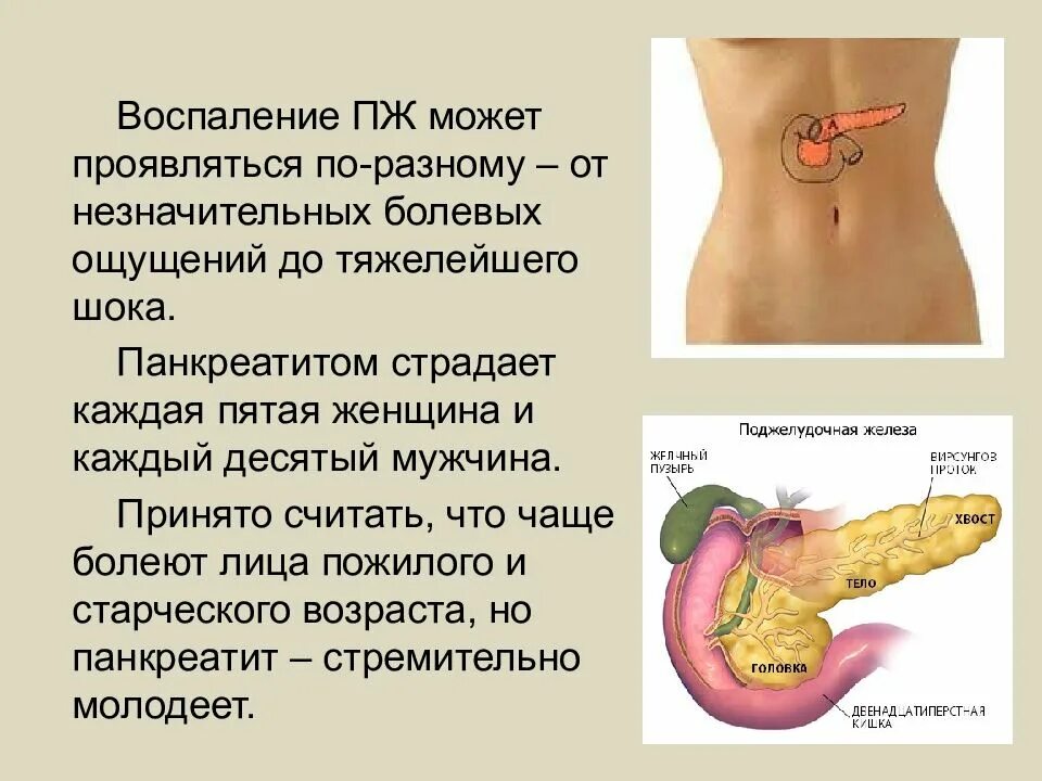 От чего может болеть поджелудочная. Поджелудочная железа симптомы. Поджелудочная симптомы у женщин. Если болит поджелудочная железа симптомы у женщин.