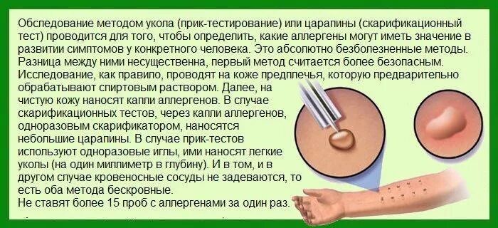 Как проверить аллергию на кошек