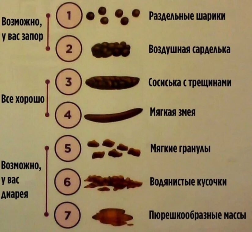 Какого цвета нормальный кал у человека. Виды кала. Виды стульев. Виды кала у человека. Виды кала у взрослого.