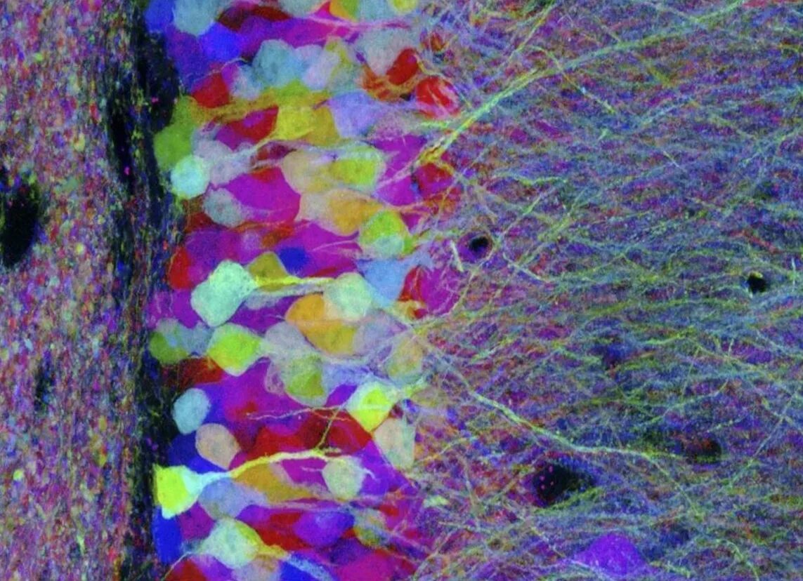 Peered into. Клетки мозга под микроскопом. Микромир под микроскопом. Микрокосмос клетки. Снимок флуоресцентного микроскопа мозга крысы.