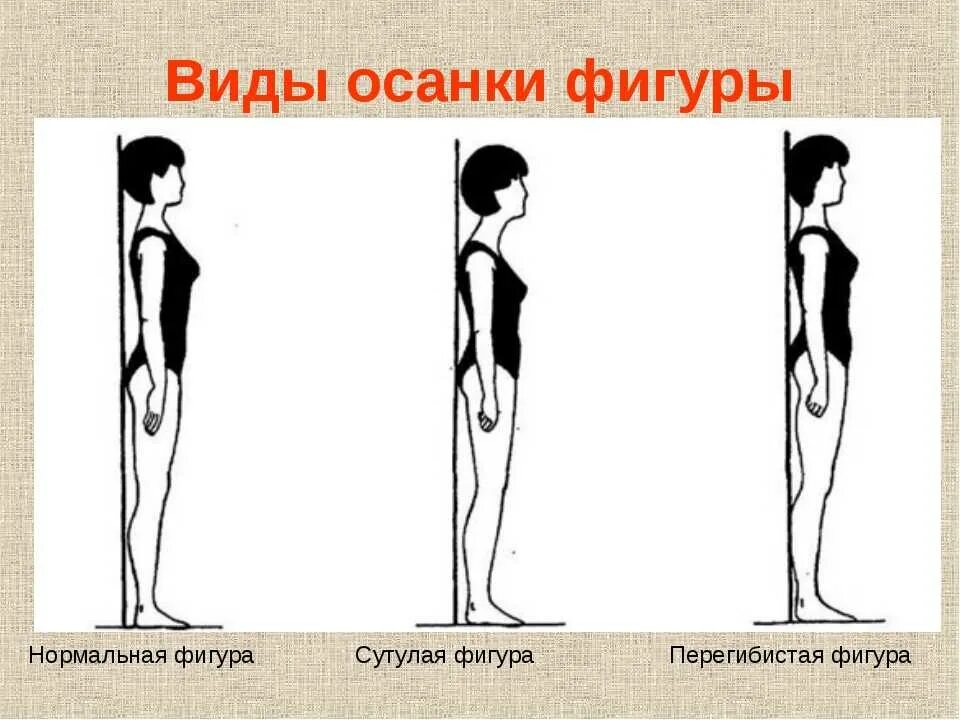 Почему стоя становится плохо. Искривление позвоночника сутулость. Упражнения для исправления сутулости осанки у. Упражнения для детей от сутулости и сколиоза. Гимнастика искривление осанки упражнения.