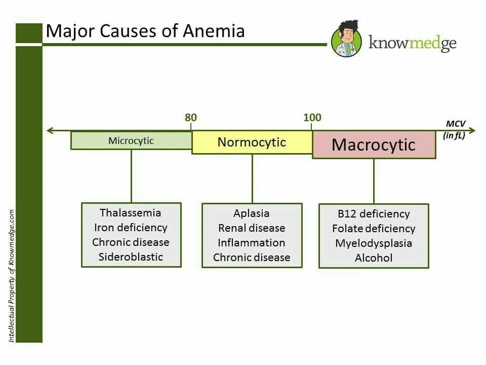 Causes of anemia. Types of anemia. Cause of anaemia. Types of anaemia.