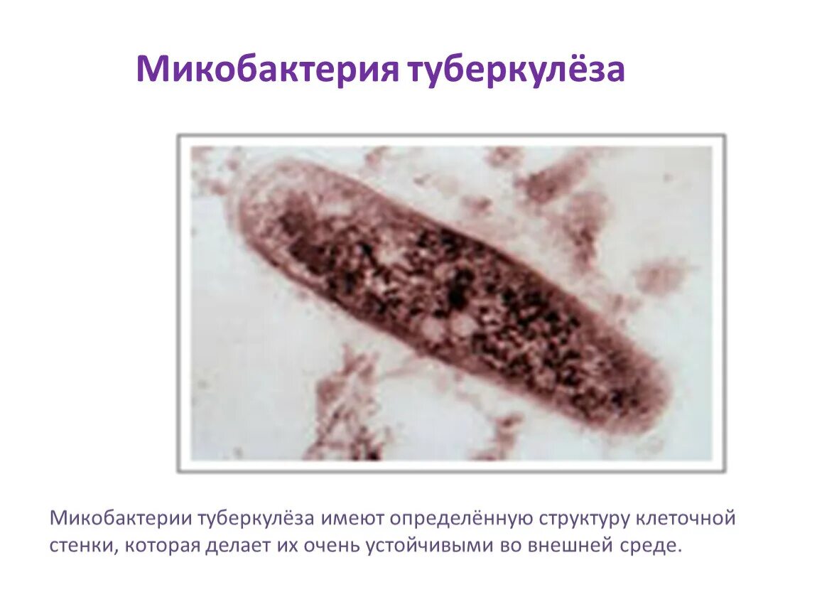 Род туберкулеза. Микобактерия палочки Коха. Палочки – микобактерия туберкулеза. Палочка Коха возбудитель туберкулеза. Палочка Коха Mycobacterium tuberculosis.