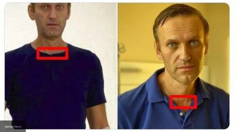Смерть навального сколько лет. Леша Навальный. Навальный после отравления. Навальный фото.