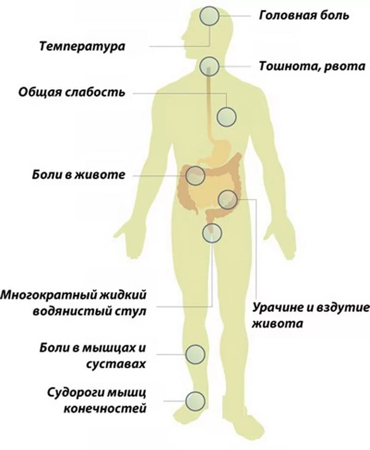 Признаки сальмонеллеза у человека симптомы