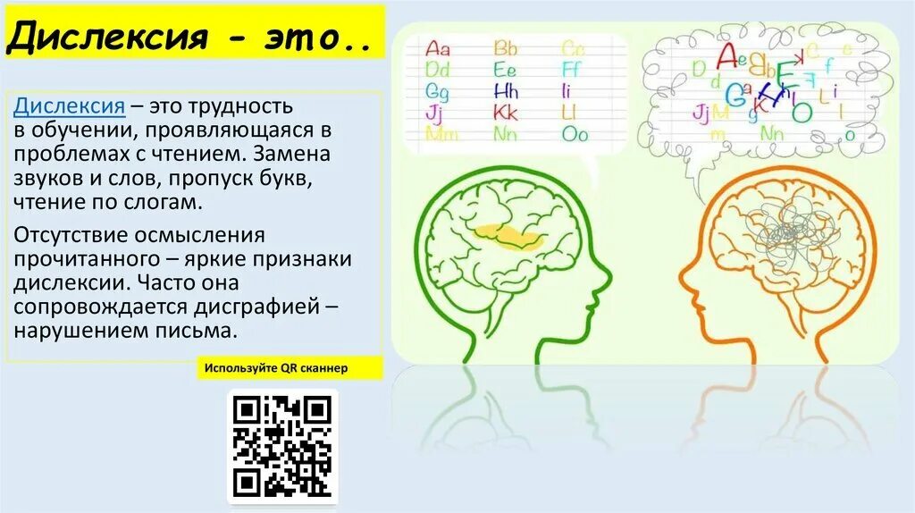 Страдает дислексией. Дислексия. Дислексия это в логопедии. Дислексия люди. Дислексия признаки.