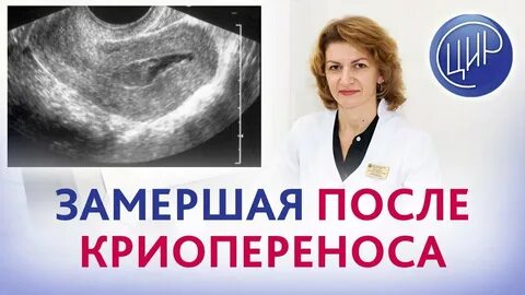 Новая беременность после замершей