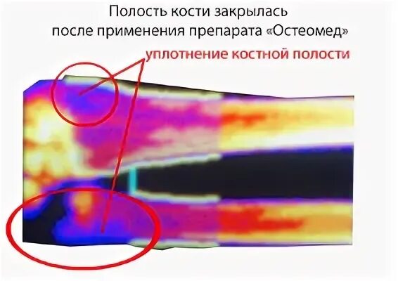У кого большие полости в костях
