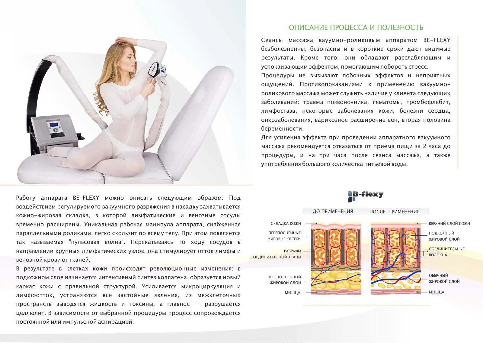 LPG аппарат b-Flexy. Вакуумно-роликовый аппарат LPG Flexy. LPG массаж на аппарате Vortex. Вакуумно-роликовый массаж аппарат b-Flexy. Отзывы после лпджи массаж