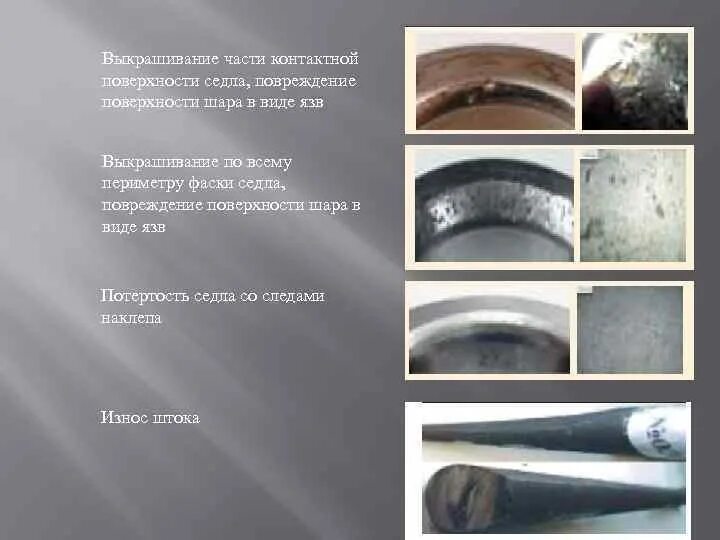 Частичное повреждение поверхности. Дебридмент вращательной манжеты. Разрыв внутренней поддерживающей связки надколенника. Разрыв мениска коленного сустава симптомы. Краевой перелом мыщелка большеберцовой кости.
