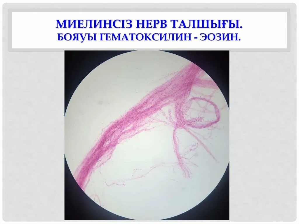 Безмиелиновые волокна гистология. Нервные волокна препарат. Миелиновые нервные волокна препарат. Мякотные миелиновые волокна. Нервные волокна препарат.
