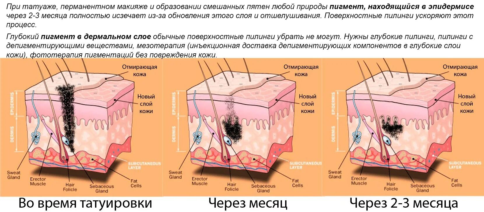 В собственно коже отсутствует пигмент. Глубина введения пигмента в кожу. Заживление кожи пигмент. Внедрение пигмента в кожу.