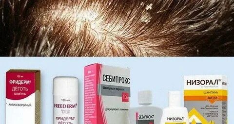 Себорея головы лечение препараты недорогие но эффективные