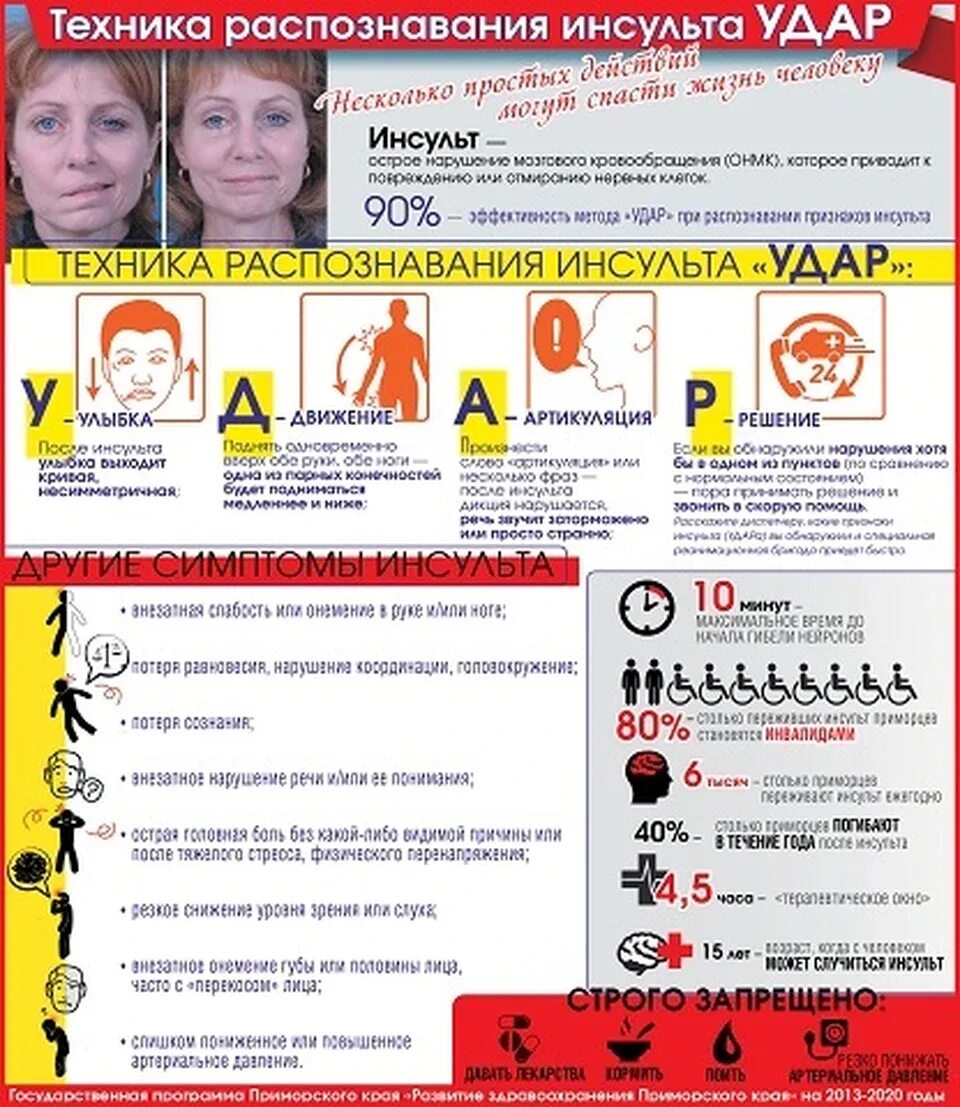 Пациент с инсультом. Как распознать инсульт. Симптомы инсульта удар. Памятка по борьбе с инсультом. Форум инсульта истории людей.