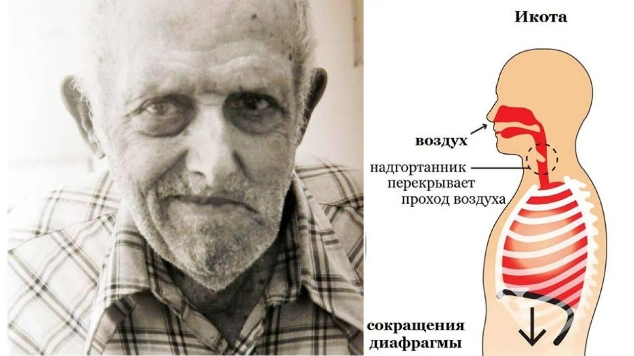Самый продолжительный приступ икоты. Самая долгая икота в мире. Самая долгая икота в мире. Самая долгая икота. Самая долгая икота в мире.