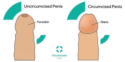 circumcised vs uncircumcised penis - cleaning78.ru.