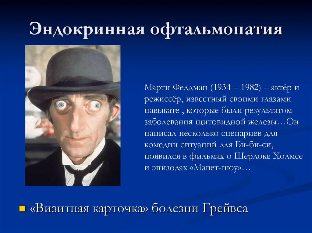 Пульс терапия при эндокринной офтальмопатии
