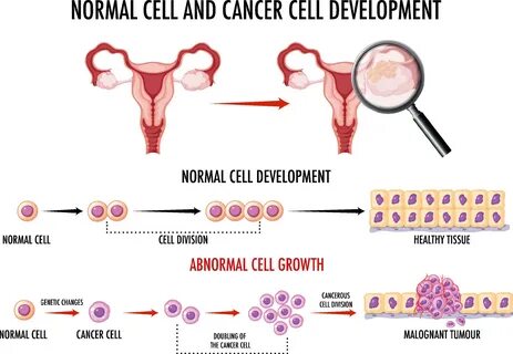 Download Diagram showing normal and cancer cell for free.